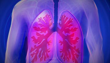 cancer pulmon nuevas alternativas tratamiento